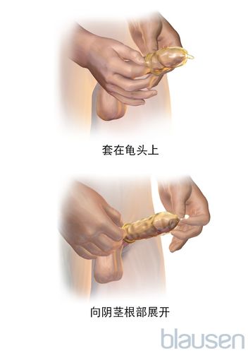 妈妈说我带套才可以：××安全套，给你全方位的保护