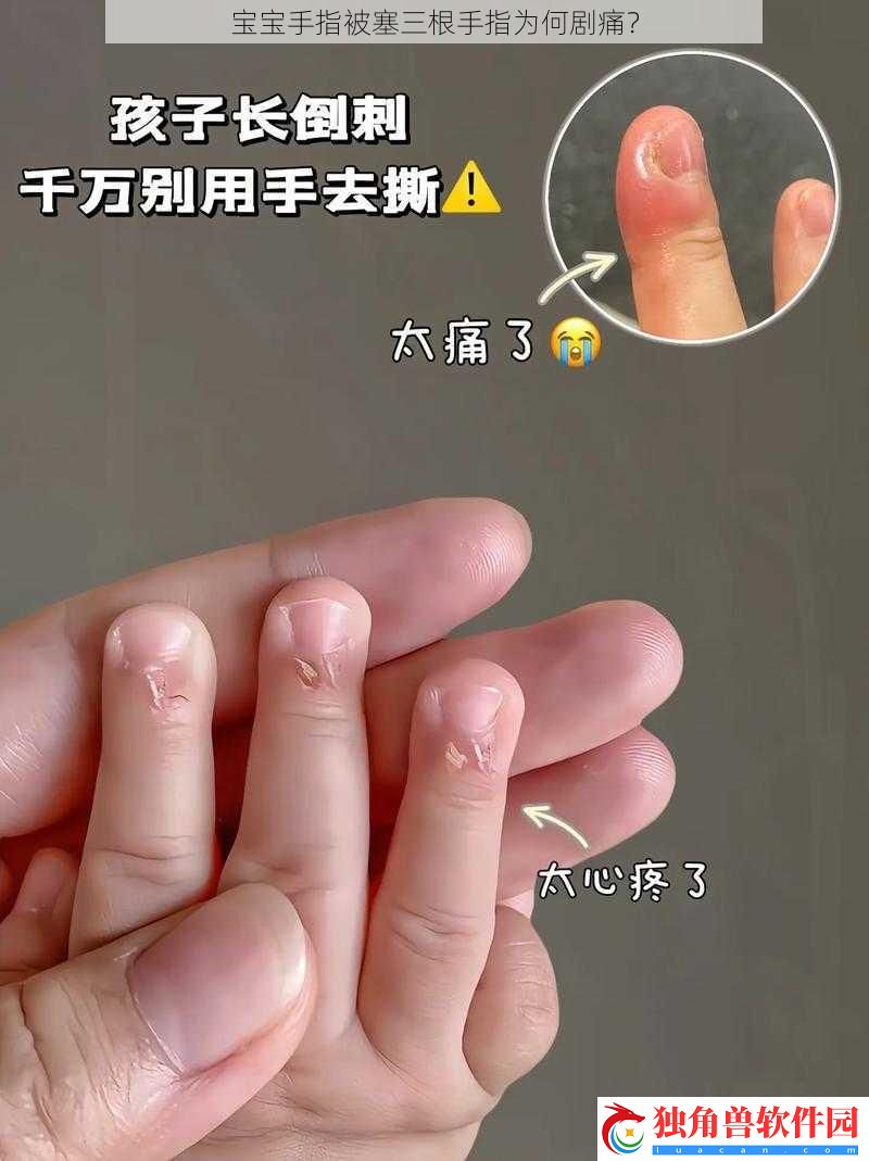 宝宝手指被塞三根手指为何剧痛