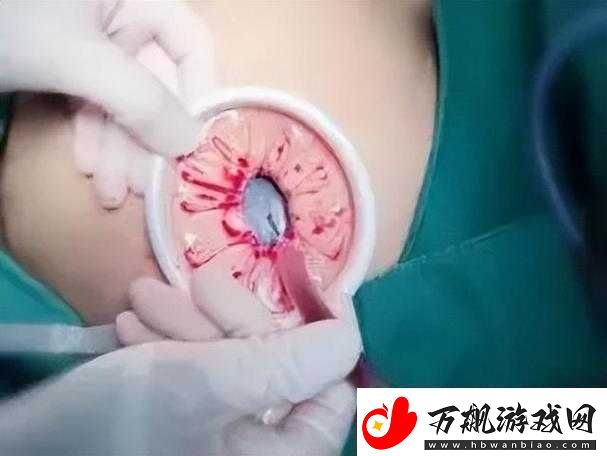 腹部灌满隆起精液令人震撼的奇特景象