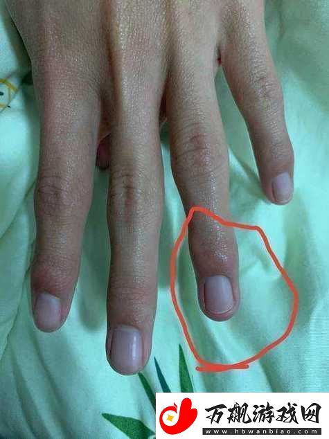 一根手指为何轻轻触碰就疼得如此厉害